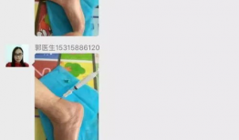 小针刀操作视频,精准施术，轻松掌握微创治疗技巧